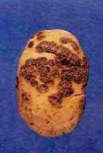 common potato scab